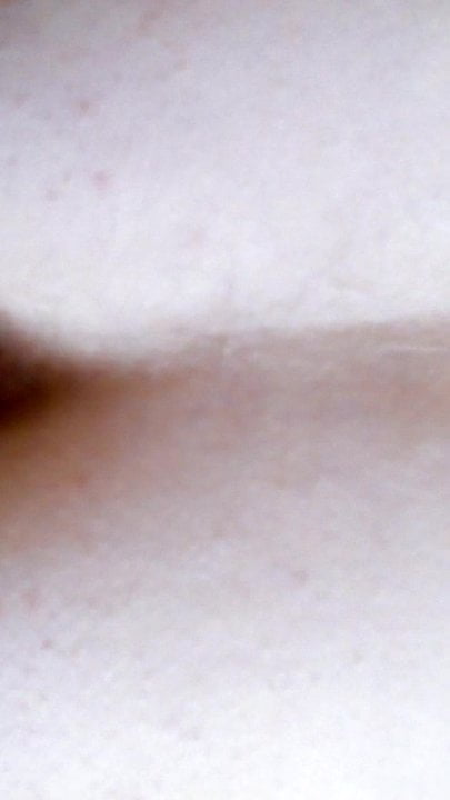 anal