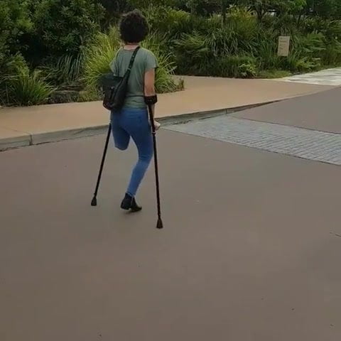 amputee