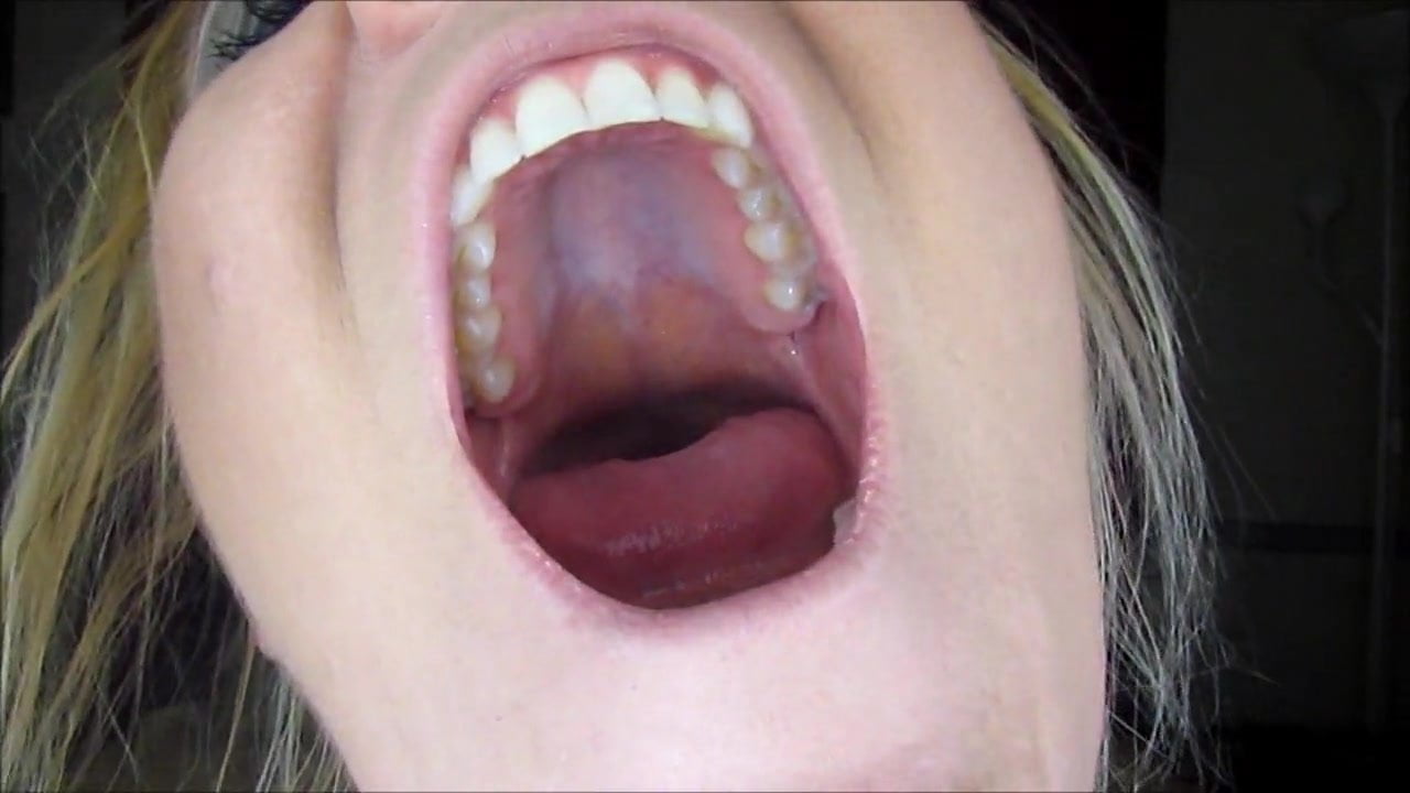 Yawning Roof Mouth