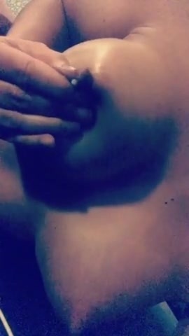 Lactating breast